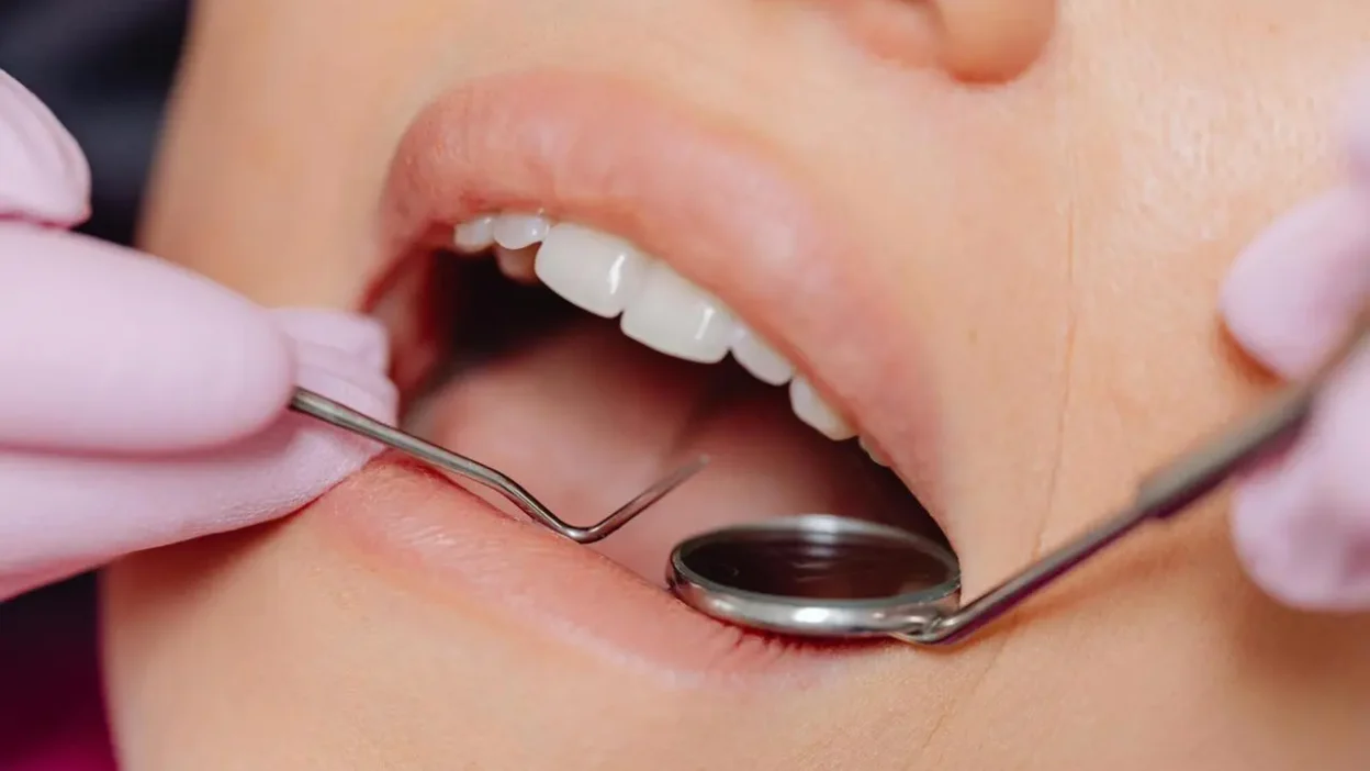 Common Dental Procedures and What to Expect