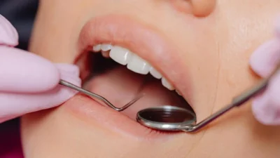 Common Dental Procedures and What to Expect