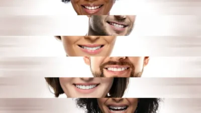 Smile Makeover Timelines: Planning Around Travel, Events, and Healing