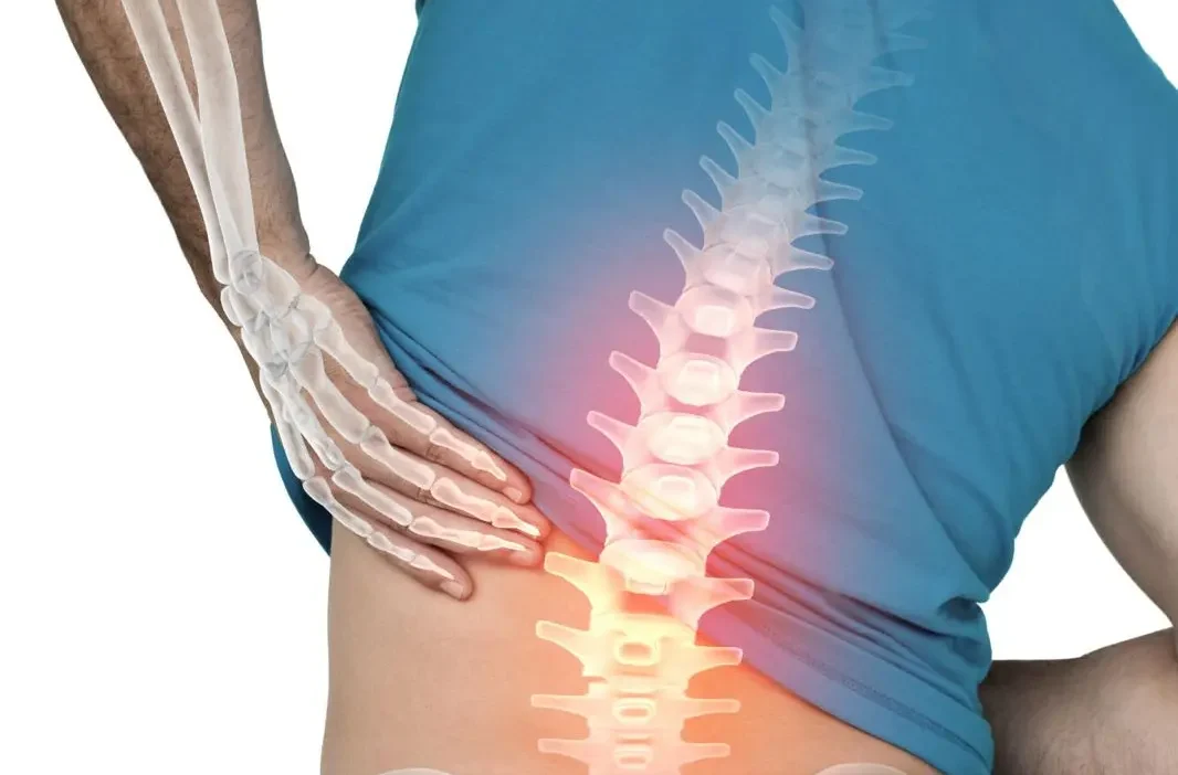 When Rest Isn't Enough Understanding Lingering Back Ache