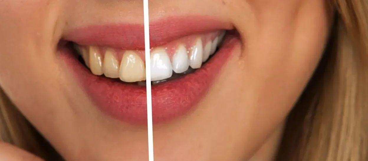 Smile Confidence Secrets: Fresh Cosmetic Dentistry Insights