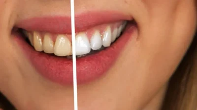 Smile Confidence Secrets: Fresh Cosmetic Dentistry Insights