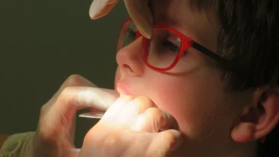 Laser Dentistry Benefits for Kids: Gentle and Comfortable Dental Care