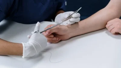 Essential Wound Care Supplies for Fast and Safe Healing