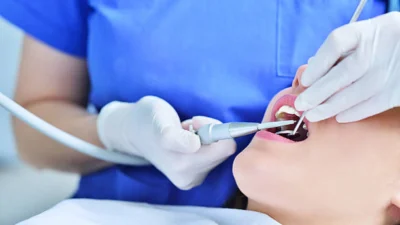 Choosing the Right Prosthodontist: Key Factors to Consider