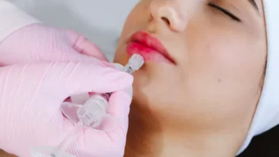The Ultimate Beginner Guide to Getting Botox