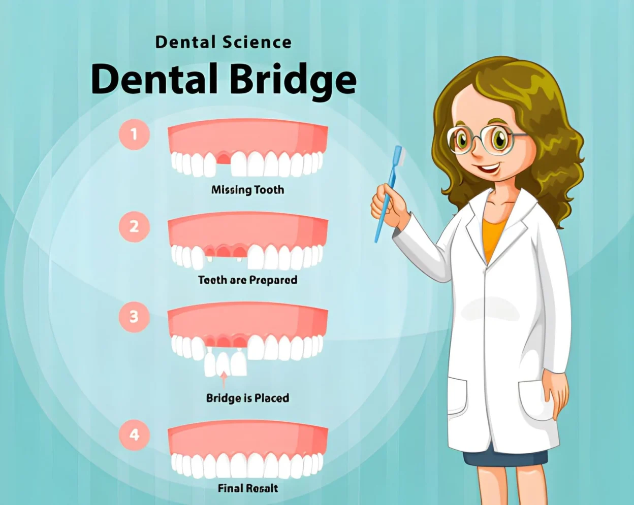 Dental Bridge 101: What You Need to Know Before Your Appointment